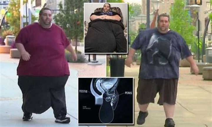 Dan Maurer: Death, Obituary, TLC, Scrotal Lymphedema, Update 2021 After Surgery, Wife, Wikipedia